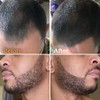 Follicle Booster Kit Estilismo Barba Piz Hombre