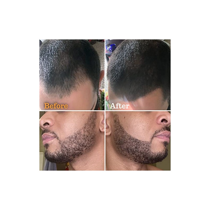 Follicle Booster Kit Estilismo Barba Piz Hombre