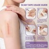 Reusable Silicone Scar Tape for Effective Scar Treatment
