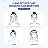 QUARXERY 3 in 1 Precisely Anti Acne Acne Spot Saviour