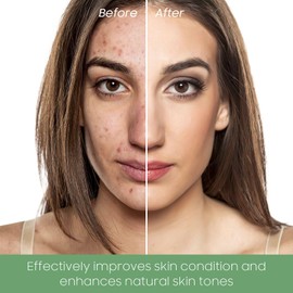 PAINISTIC Green Tea Clay Face Mask - Green Tea Skin Care for Blackheads Removal, Pore Cleansing, Deep Cleanse Mask for All Skin Types (2 PCS)