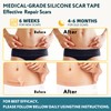 Silicone Scar Sheets, Silicone Scar Tape for Surgical Scars -