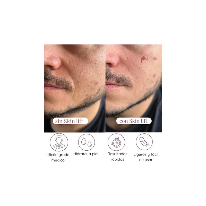 Parches Antiedad de Silicona Skin Lift Reutilizables Da y Noche