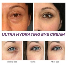 Crema para ojos Xylane para ojeras e hinchazón, crema antiarrugas para ojos con cafeína/Pro Xilane Active, crema antienvejecimiento activa para reparar y reafirmar los ojos para la oxidación, atenúa
