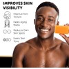 VALITIC- Jabón de ácido kójico para hiperpigmentación - con glutatión,