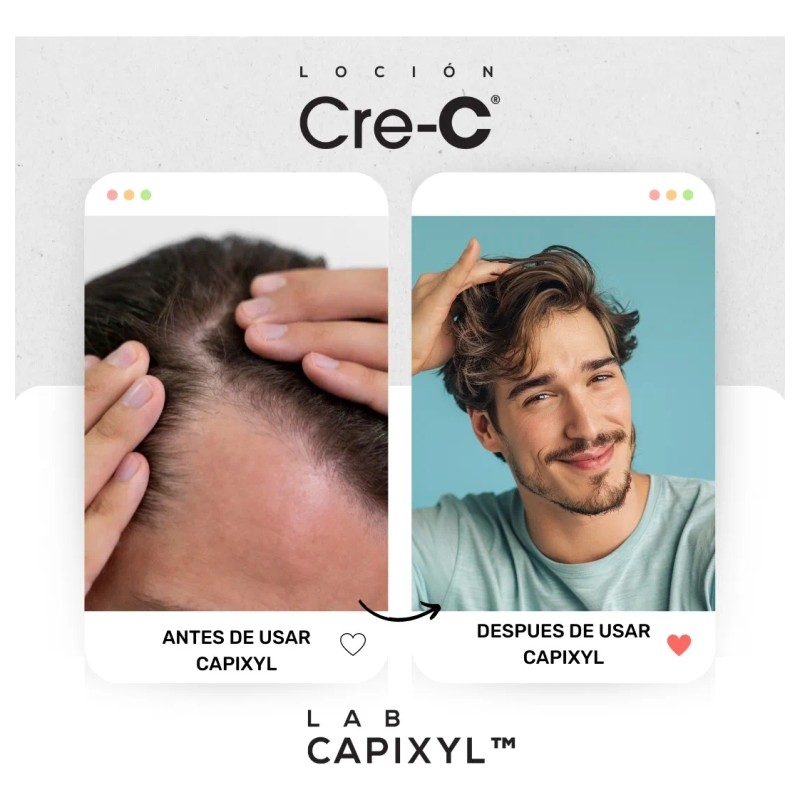 Loción Regeneradora Capilar Lab Capixyl | Cre-c