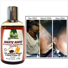 Fountain Mighty Roots Jamaican Pimento and Black Castor Oil with Shampoo and Conditioner Receding Hairline Combo