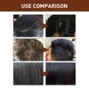 3PCS Ginger Hair Shampoo Bar - Revitalizing Growth, Improved Shedding,
