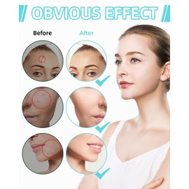 LEAZZLE 360 Stück Pimple Patches Hydrokolloid,Pickel Patch Unsichtbare Natürliche Hyaluronic,Transparentes Pickel Pflaster,Unsichtbare mit Teebaumöl Tag,Schnelle Heilung Große,Acne Patch Pflaster Anti