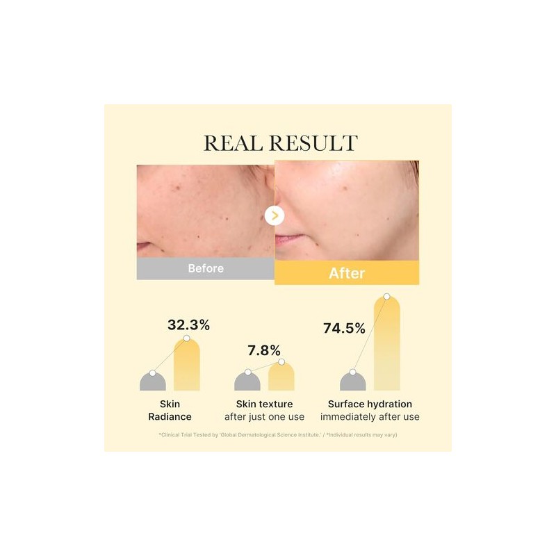 MEDICUBE [MEDICUBE]Kojic Acid Turmeric Gel Mask (4ea)