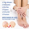 Ubat gatal kulit Cream gatal 止癢膏 20g skin Antibacterial skin