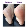 KaKaTo LaBo by baren Heel Lab FOOT SOFTENER AT-HOME (100ml)