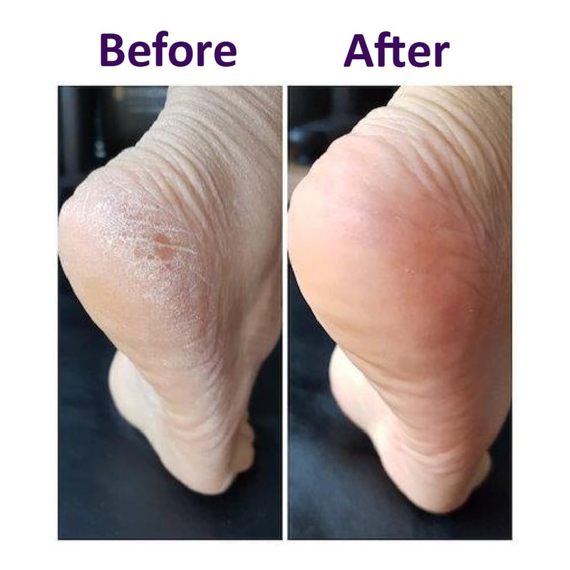 KaKaTo LaBo by baren Heel Lab FOOT SOFTENER AT-HOME (100ml)