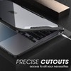 SUPCASE for MacBook Air 15 Inch Case 2025/2024/2023 (Unicorn Beetle),