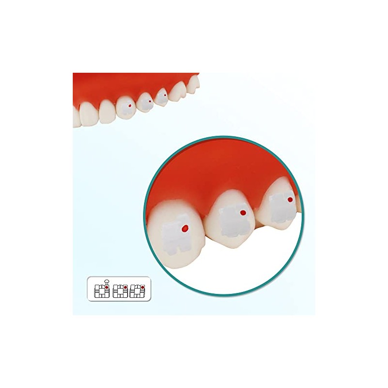 10 Paquetes de Soportes Dentales Cerámicos para Brackets Ortodónticos de