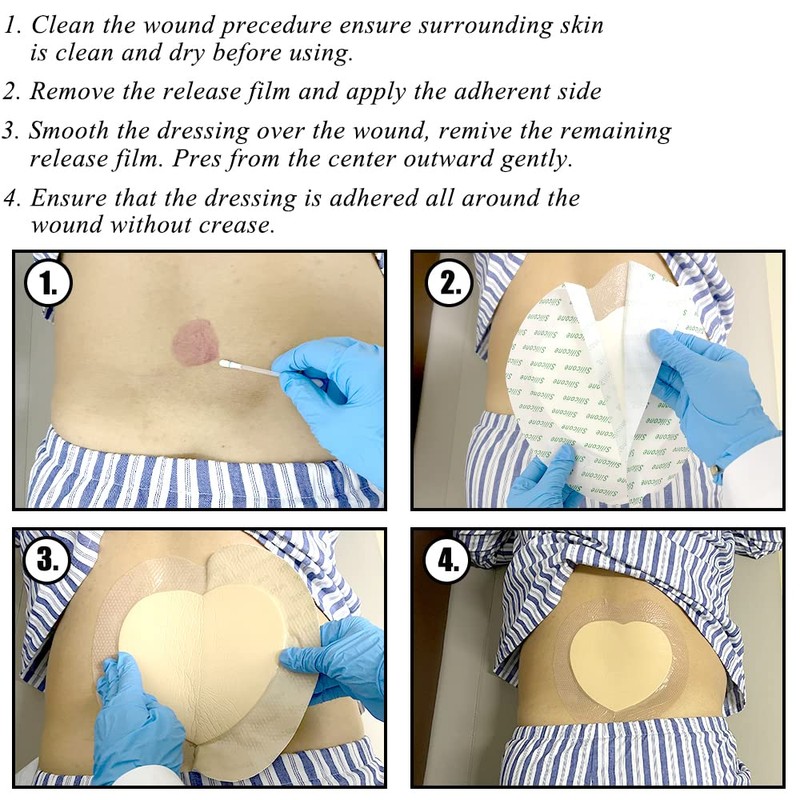 Sacral Foam Wound Dressing - Pressure Adhesive Pad for Elderly