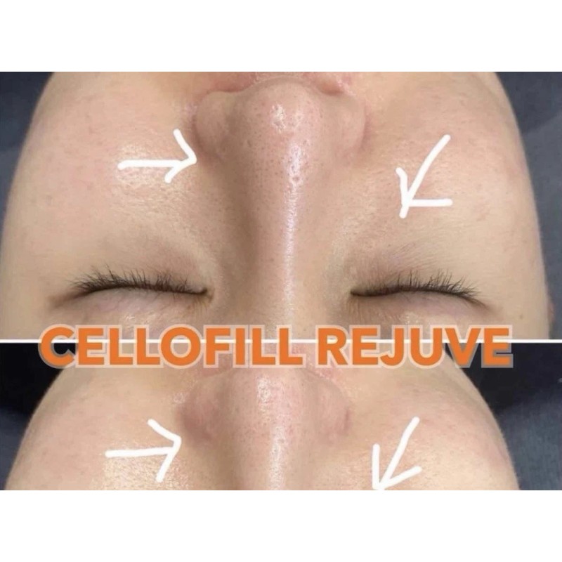 CELLOFILL REJUVE 3ml Vial | Korean Glow Booster for Skin