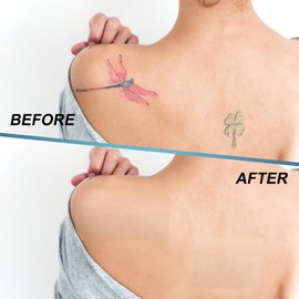 AFGHOUZ Body Concealer Makeup Patch, Waterproof Cover up Makeup, Second Skin Cover up Tape, Body Coverage Perfector