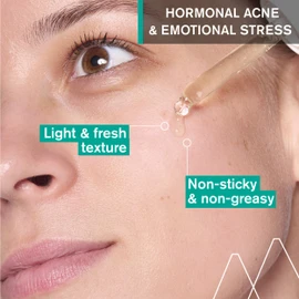 Uriage Hyseac Anti-Acne Serum - 30ml - Clear Skin Solution for Oily and Acne-Prone Skin