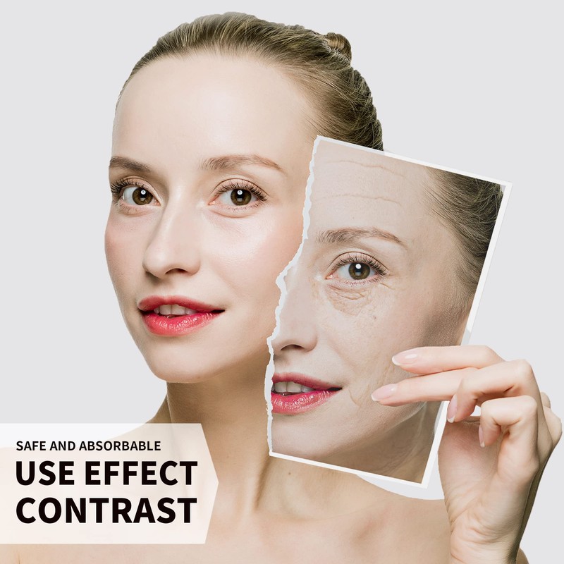 HYPOD PDO Threads, Smoothing Line For Face And Body Lift,