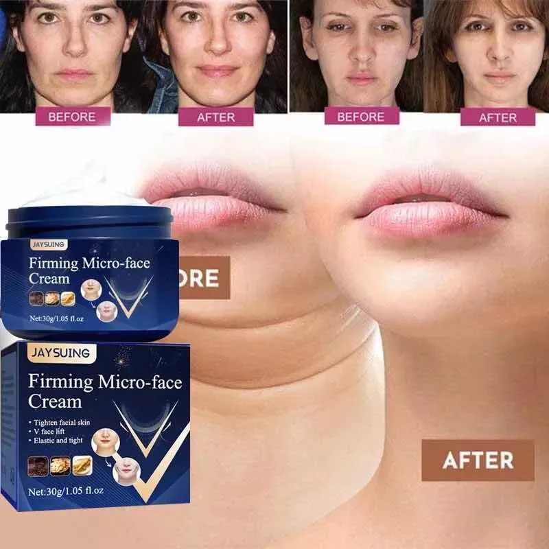 Tratamiento Crema Elimina Papada Moldea El Rostro No Serum Todo