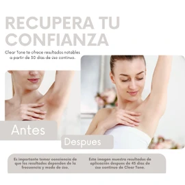 Crema Corporal Despigmentante - Clear Tone 50g.- Manchas Solares, Manchas por Edad, Desequilibrios hormonales, Hiperpigmentacion - Con Vitamina E, Retinol, Elastina, Karité, Árbol de Té, y Caléndula. - Codos, Rodillas, Tobillos, Axilas, Rostro y Manos.