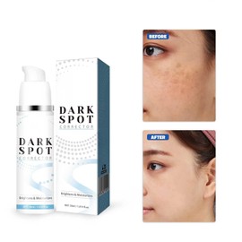 Hppsctink 2pcs Essenz zur Entfernung dunkler Flecken, Essenz zur Entfernung von dunklen Flecken, Hellt Hautverfärbungen und Melanin auf, Pflegende & aufhellende Behandlungsessenz, 2pcs*30ml, serum