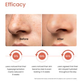 Earth Rhythm Skin Clarifying Serum, 2% Alpha Arbutin with Hyaluronic Acid, For All Skin Types - 30 ML