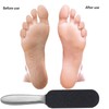 1 Piece Callus Remover with 20 Foot Files to Replace