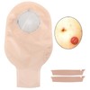 10pcs Disposable Colostomy Bag Soft Skin Friendly Ostomy Bag Pouch