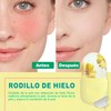 Kit de Rodillo de Hielo para la Cara y Tabla