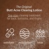 Brilliant Booty Kit | Butt Acne Clearing Lotion and ExfoliMATE