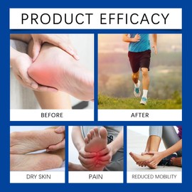 South Moon Plantar Fasciitis Cream,Herbal Therapy Product for Heel Spur,Heel Spurs, Knee, Hands & Legs(60G/2.12Oz)