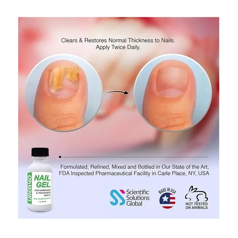 Scientific Solutions UREA 40% Nail Debridement Gel For Damaged Thickened