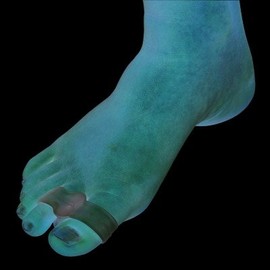 MCK10333000 - Pedifix Toe Spacer Visco-Gel ToeBuddy One Size Fits Most Without Closure Left or Right Foot