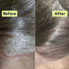 Delhicious Scalp-Eaze Scalp Balm Amla Berry & Mango Butter