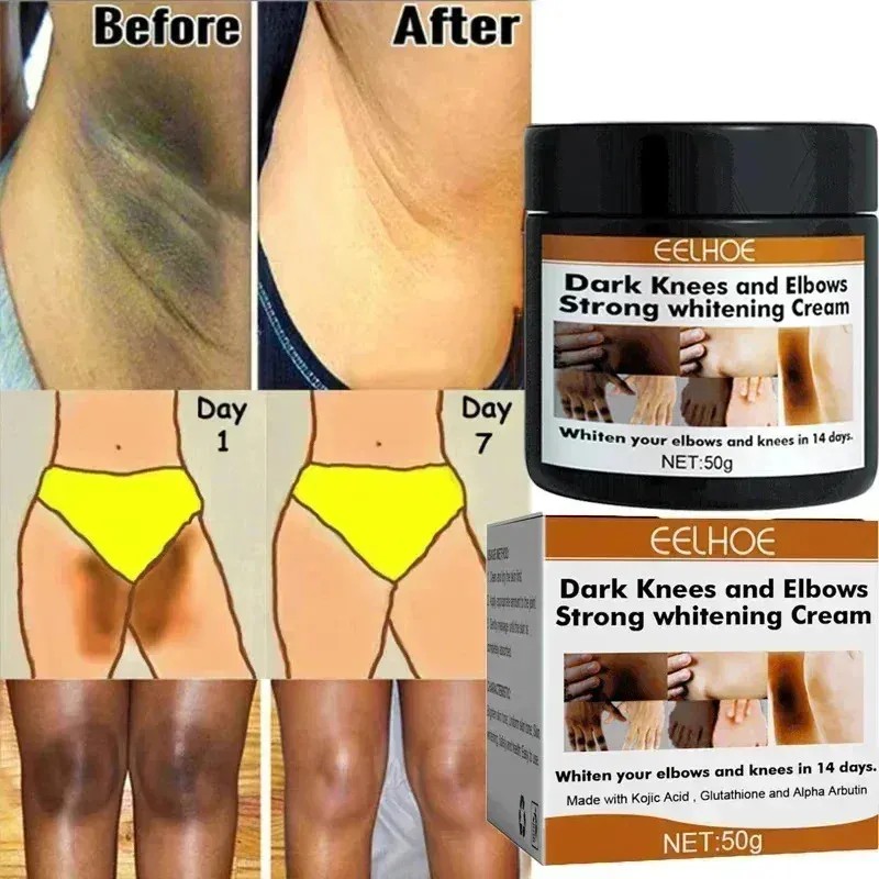 */crema Iluminadora De Nudillos Oscura Para Manos, Codos Y R