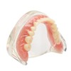 Dental Model Overdenture Inferior 4 Implants Demo Mandibular Model for