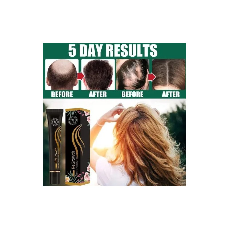 Rollo De Suero Orgánico Para El Crecimiento Del Cabello Recr