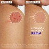 ADerma Epitheliale Ultra Repair Crema Antimarcas 40 ml