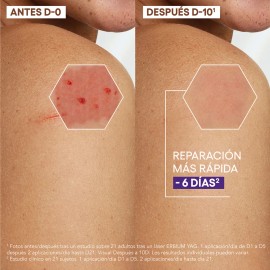 ADerma Epitheliale Ultra Repair Crema Antimarcas 40 ml                                                                                                