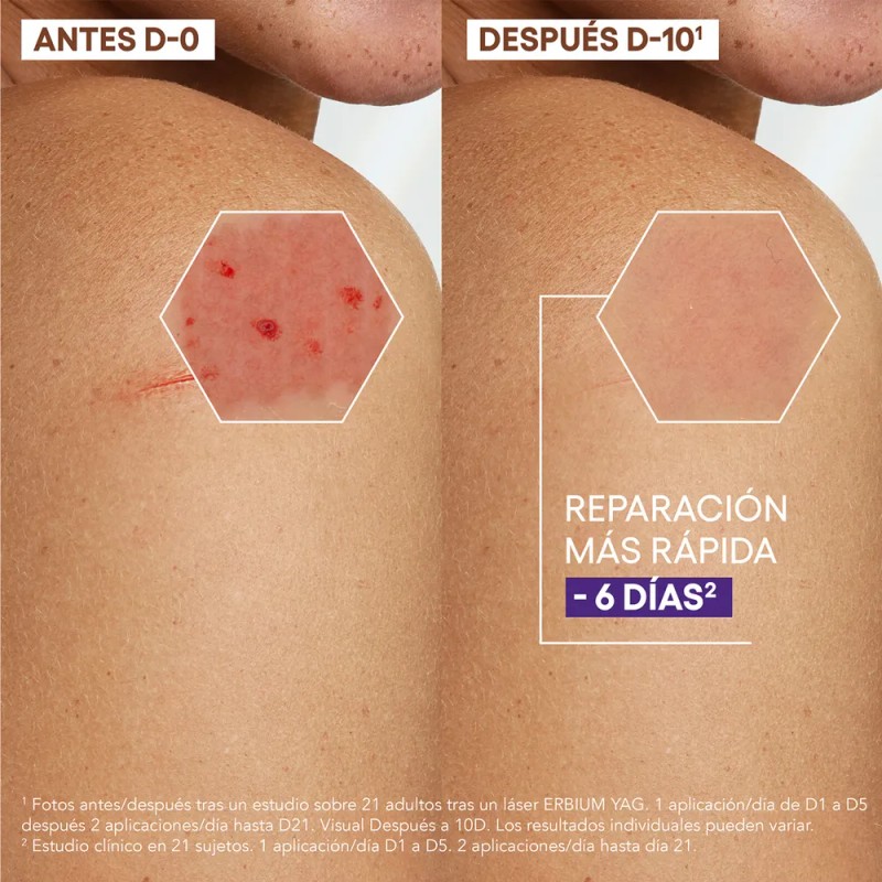 ADerma Epitheliale Ultra Repair Crema Antimarcas 40 ml