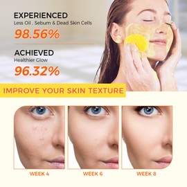 OUKEYA 50pcs Kojic Acid & Turmeric Exfoliating Cleansing Pads for Face, Turmeric Pad, Gentle Exfoliator Cotton Pads for Dull & Oily Skin, Brightening Facial Wipes, Skin Care Pads