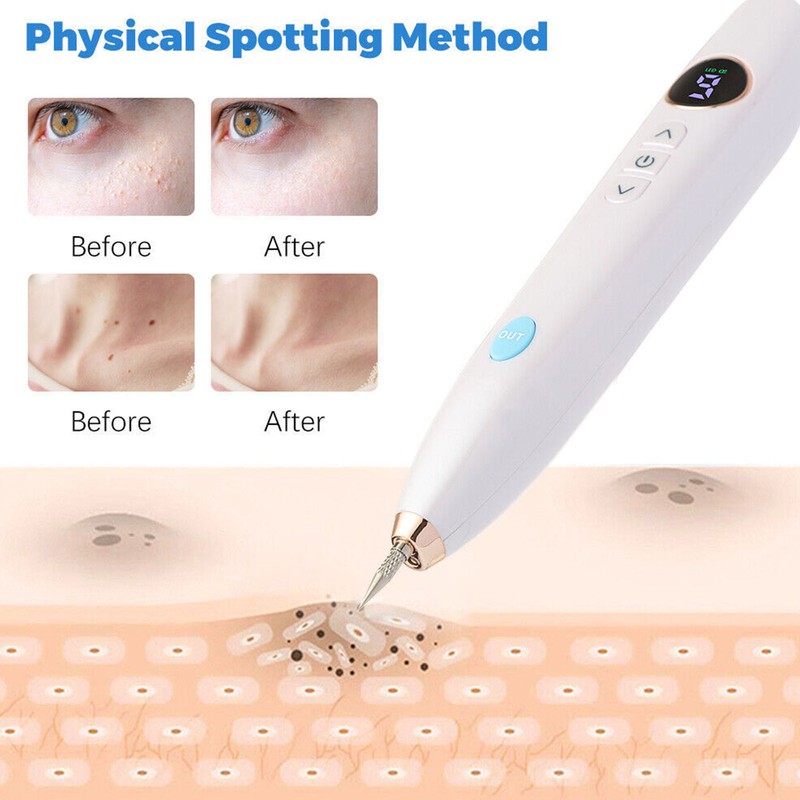 Spot Removing Beauty Pen LED Screen Adjustable 9 Gears Plug