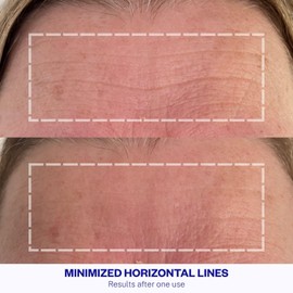 WRINKLES SCHMINKLES,clear Anti-Wrinkle Patch for the Forehead