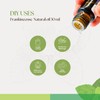 Roots & Above Frankincense Essential Oil 30ml (1.01 oz) –