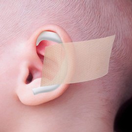 Garneck Protruding Ear Support 5 Pairs Auricle Corrector Invisible Tape Silicone Tape Ear Valgus Auricle Ear Support Silicone Patch External Auricle Corrector Valgus Auricle Corrector