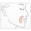See detailed description Nasolabial wrinkle patch lifting tape face between