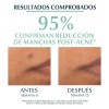 Eucerin Dermopure Oil Control Sérum Triple Efecto Antibrillo para Piel