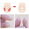 Ingrown Toenail Pedicure Tool 10pcs/bottle Straightening Clip Curved BS Brace